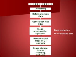 processing
Reformatted raw
data
Image
reconstruction
algorithm
Reconstructed
image of CT
numbers
Convolution with
filter
Image storage,
display,
recording,
archiving
Back projection
Of convoluted data
 