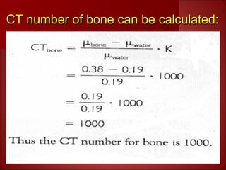 CT number of bone can be calculated:CT number of bone can be calculated:
 