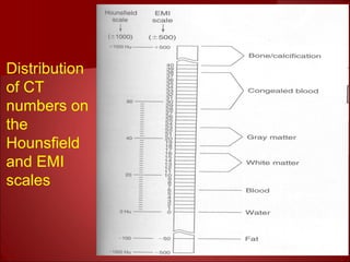 Distribution
of CT
numbers on
the
Hounsfield
and EMI
scales
 