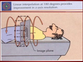 Basics of CT- Lecture 5.ppt