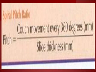 Basics of CT- Lecture 5.ppt