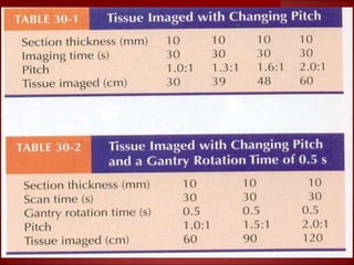 Basics of CT- Lecture 5.ppt