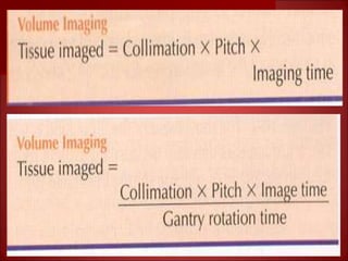 Basics of CT- Lecture 5.ppt