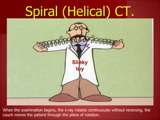 Spiral (Helical) CT.
Slinky
toy
When the examination begins, the x-ray rotates continuously without reversing, the
couch moves the patient through the plane of rotation.
 