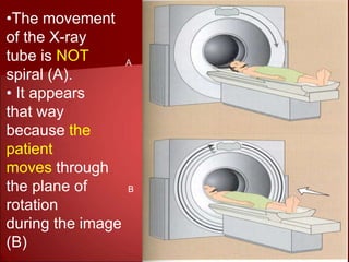 A
B
•The movement
of the X-ray
tube is NOT
spiral (A).
• It appears
that way
because the
patient
moves through
the plane of
rotation
during the image
(B)
 
