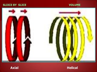 SLIICE BY SLICE VOLUME
Axial Helical
 