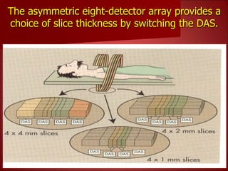 Basics of CT- Lecture 6.ppt