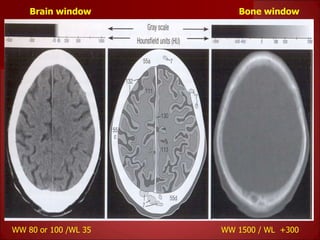 Basics of CT- Lecture 7.ppt