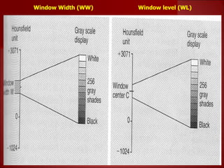 Window Width Window Level Basics of CT- Lecture 7.ppt