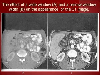 Basics of CT- Lecture 7.ppt