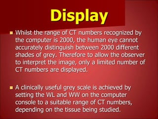 Basics of CT- Lecture 7.ppt