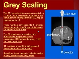 Basics of CT- Lecture 7.ppt
