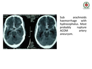 Workshop on Neuroimaging - APICON 2020 | PPTX