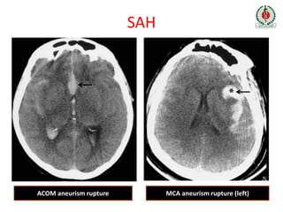 Workshop on Neuroimaging - APICON 2020 | PPTX
