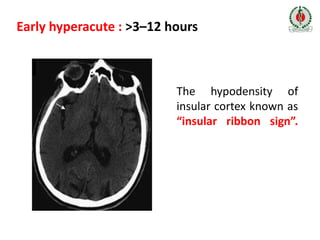 Workshop on Neuroimaging - APICON 2020 | PPTX