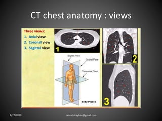 CT chest anatomy : views
8/27/2019 zannatulrayhan@gmail.com
 