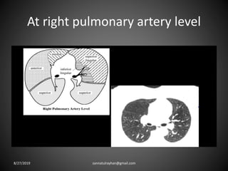 At right pulmonary artery level
8/27/2019 zannatulrayhan@gmail.com
 