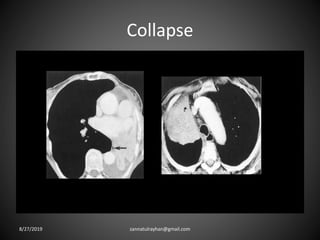 Collapse
8/27/2019 zannatulrayhan@gmail.com
 