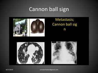 Cannon ball sign
8/27/2019 zannatulrayhan@gmail.com
 