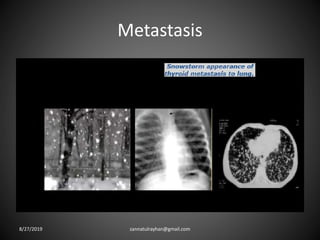 Metastasis
8/27/2019 zannatulrayhan@gmail.com
 