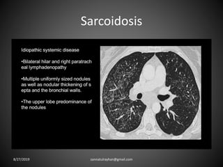 Sarcoidosis
8/27/2019 zannatulrayhan@gmail.com
 