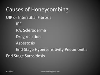 Causes of Honeycombing
UIP or Interstitial Fibrosis
IPF
RA, Scleroderma
Drug reaction
Asbestosis
End Stage Hypersensitivity Pneumonitis
End Stage Sarcoidosis
8/27/2019 zannatulrayhan@gmail.com
 