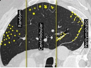 8/27/2019 zannatulrayhan@gmail.com
 