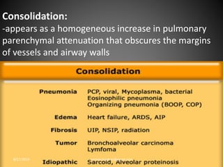 Consolidation:
-appears as a homogeneous increase in pulmonary
parenchymal attenuation that obscures the margins
of vessels and airway walls
8/27/2019 zannatulrayhan@gmail.com
 