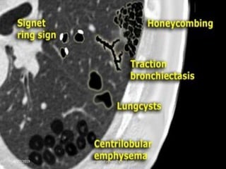 8/27/2019 zannatulrayhan@gmail.com
 