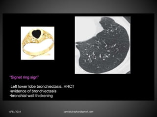 8/27/2019 zannatulrayhan@gmail.com
 