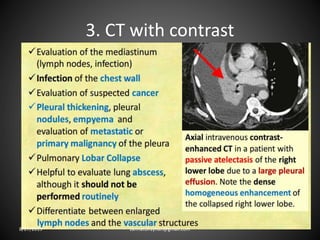 3. CT with contrast
8/27/2019 zannatulrayhan@gmail.com
 