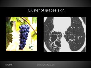 8/27/2019 zannatulrayhan@gmail.com
 