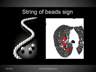 8/27/2019 zannatulrayhan@gmail.com
 