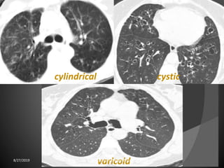 cysticcylindrical
varicoid8/27/2019 zannatulrayhan@gmail.com
 
