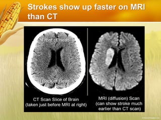 Basics of ct mri | PPTX