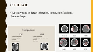CT HEAD
• Typically used to detect infarction, tumor, calcifications,
haemorrhage
 