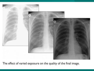 Basics Of CXR interpretation www.radiologydefinition.com