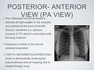 POSTERIOR- ANTERIOR
VIEW (PA VIEW)➢The collimated horizontal beam is
directed at right-angles to the receptor
and centred at the level of the 8th
thoracic vertebrae (i.e. spinous
process of T7) which is coincident with
the lung midpoint
➢Exposure is made in full normal
arrested inspiration
➢CXR PA OBTAINED IN EXPIRATION-
Done to demonstrate small apical
pneumothorax and air trapping due to
inhaled foreign body
 