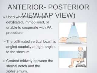 ANTERIOR- POSTERIOR
VIEW (AP VIEW)➢Used when the patient is
debilitated, immobilised, or
unable to cooperate with PA
procedure.
➢The collimated vertical beam is
angled caudally at right-angles
to the sternum .
➢Centred midway between the
sternal notch and the
xiphisternum.
 