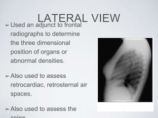 LATERAL VIEW➢Used an adjunct to frontal
radiographs to determine
the three dimensional
position of organs or
abnormal densities.
➢Also used to assess
retrocardiac, retrosternal air
spaces.
➢Also used to assess the
 