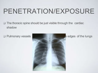 PENETRATION/EXPOSURE
❑ The thoracic spine should be just visible through the cardiac
shadow
❑ Pulmonary vessels can be traced nearly to the edges of the lungs
 