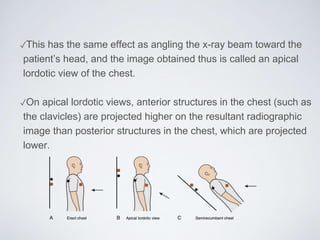 ✓This has the same effect as angling the x-ray beam toward the
patient’s head, and the image obtained thus is called an apical
lordotic view of the chest.
✓On apical lordotic views, anterior structures in the chest (such as
the clavicles) are projected higher on the resultant radiographic
image than posterior structures in the chest, which are projected
lower.
 