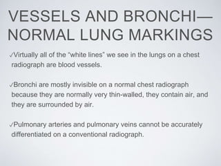 ✓Virtually all of the “white lines” we see in the lungs on a chest
radiograph are blood vessels.
✓Bronchi are mostly invisible on a normal chest radiograph
because they are normally very thin-walled, they contain air, and
they are surrounded by air.
✓Pulmonary arteries and pulmonary veins cannot be accurately
differentiated on a conventional radiograph.
VESSELS AND BRONCHI—
NORMAL LUNG MARKINGS
 