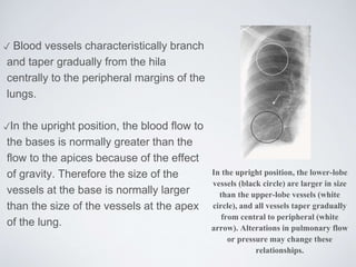 ✓ Blood vessels characteristically branch
and taper gradually from the hila
centrally to the peripheral margins of the
lungs.
✓In the upright position, the blood flow to
the bases is normally greater than the
flow to the apices because of the effect
of gravity. Therefore the size of the
vessels at the base is normally larger
than the size of the vessels at the apex
of the lung.
In the upright position, the lower-lobe
vessels (black circle) are larger in size
than the upper-lobe vessels (white
circle), and all vessels taper gradually
from central to peripheral (white
arrow). Alterations in pulmonary flow
or pressure may change these
relationships.
 