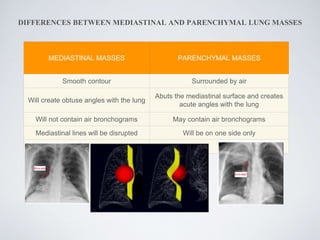 DIFFERENCES BETWEEN MEDIASTINAL AND PARENCHYMAL LUNG MASSES
MEDIASTINAL MASSES PARENCHYMAL MASSES
Smooth contour Surrounded by air
Will create obtuse angles with the lung
Abuts the mediastinal surface and creates
acute angles with the lung
Will not contain air bronchograms May contain air bronchograms
Mediastinal lines will be disrupted Will be on one side only
 