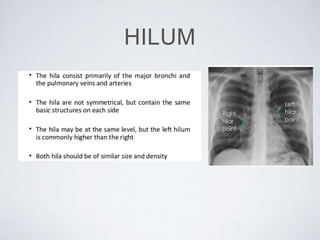 HILUM
 