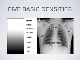 FIVE BASIC DENSITIES
 