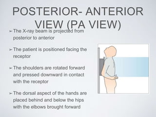 POSTERIOR- ANTERIOR
VIEW (PA VIEW)➢The X-ray beam is projected from
posterior to anterior
➢The patient is positioned facing the
receptor
➢The shoulders are rotated forward
and pressed downward in contact
with the receptor
➢The dorsal aspect of the hands are
placed behind and below the hips
with the elbows brought forward
 