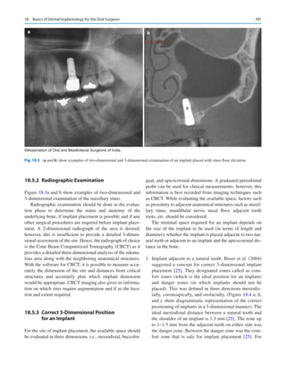 Surgeon Rpbio Example Basics_of_Dental_Implantology_for_the_Oral_Surgeon.pdf