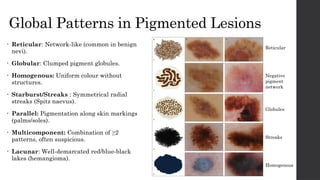 Basics of Dermoscopy seminar by dr akshata soni | PPTX